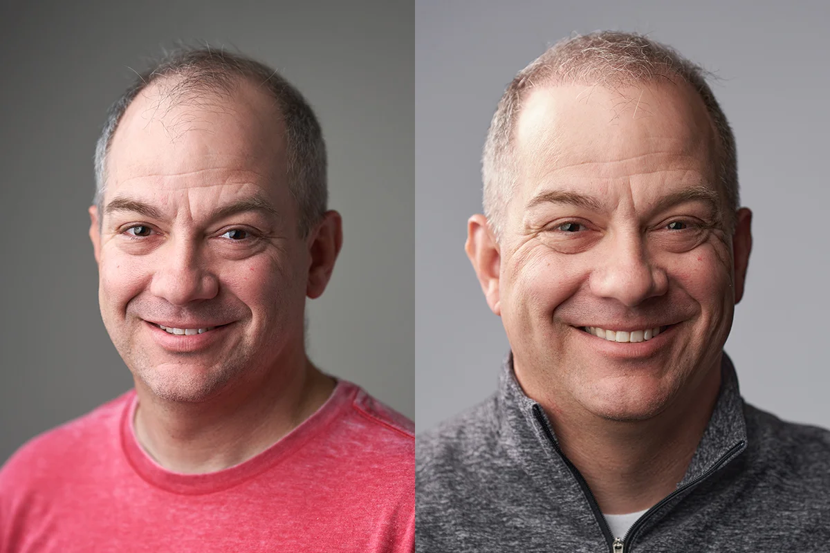 before and after photos of older man